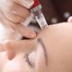 Microneedling un soin a la pointe Imaderm Geneve jeunesse du visage
