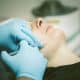 Imaderm Injection PRP