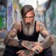 detatouage a geneve - imaderm