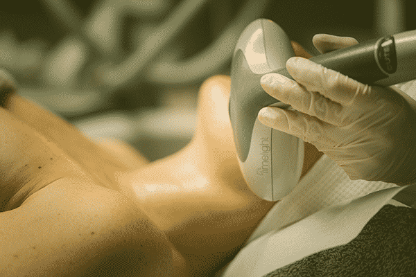 rejuvenation globale du visage - taches pigmentaires - imaderm rejuvenation globale du visage - taches pigmentaires - imaderm
