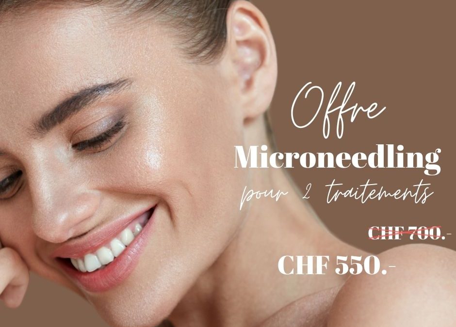 image qui présente l'offre promotion microneedling chez imaderm