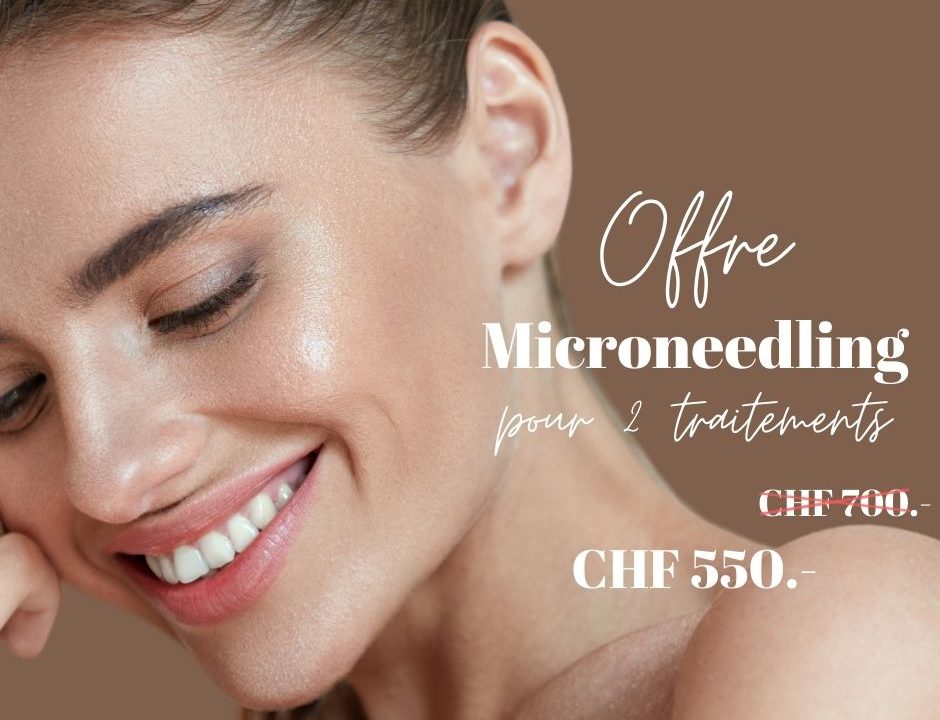 image qui présente l'offre promotion microneedling chez imaderm