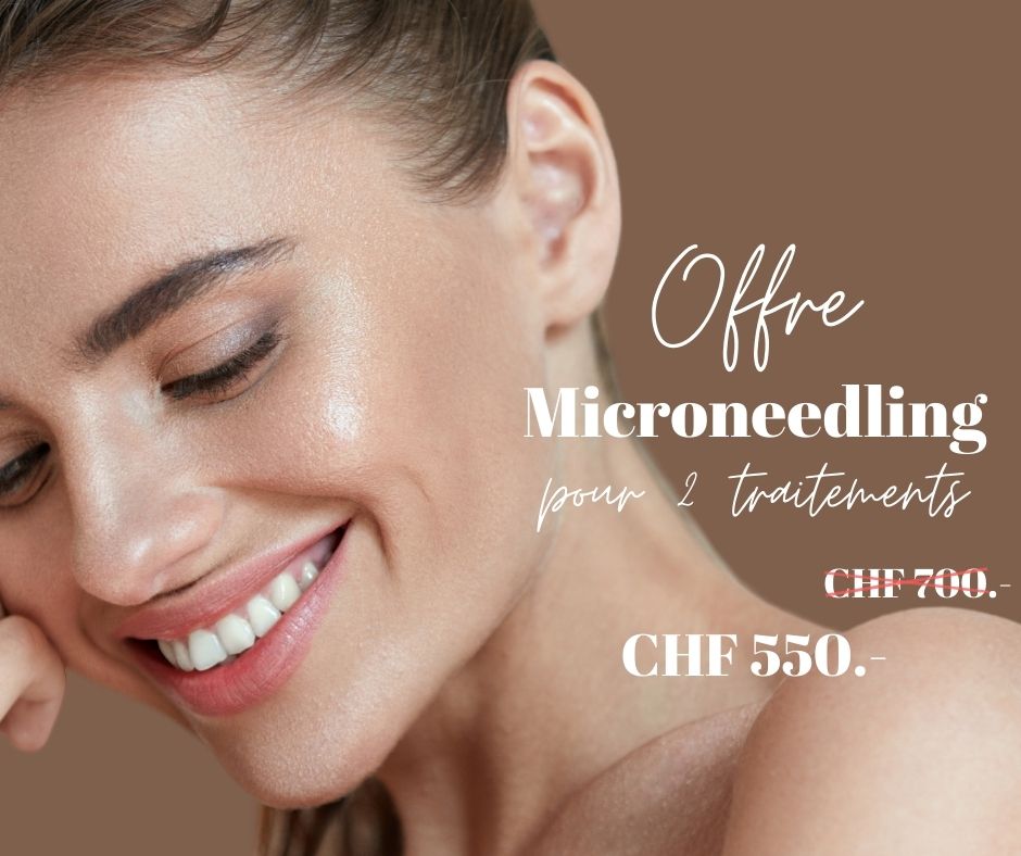 image qui présente l'offre promotion microneedling chez imaderm