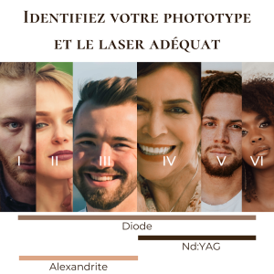 Différents lasers selon votre phototype